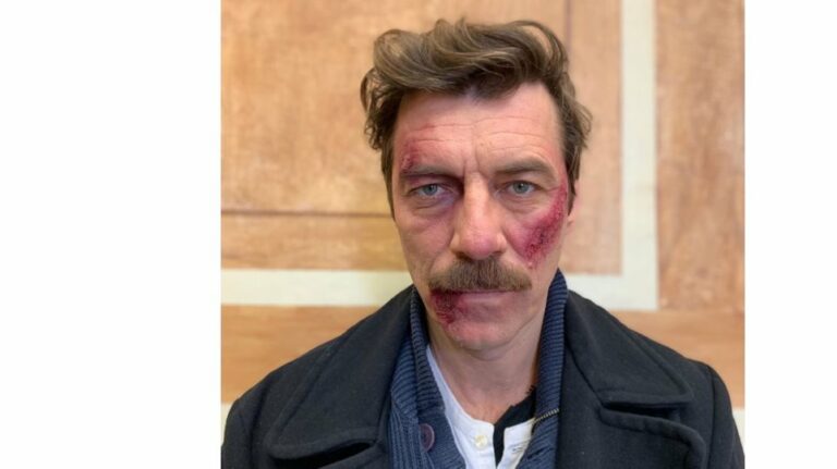 Ποιος έκανε τόπι στο ξύλο τον Γιάννη Στάνκογλου από τις Άγριες Μέλισσες;