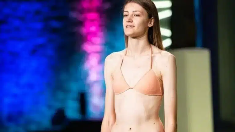 Θυμάστε την Ειρήνη Ερμίδου από το πρώτο GNTM; Η απίστευτη αλλαγή στην εμφάνισή της